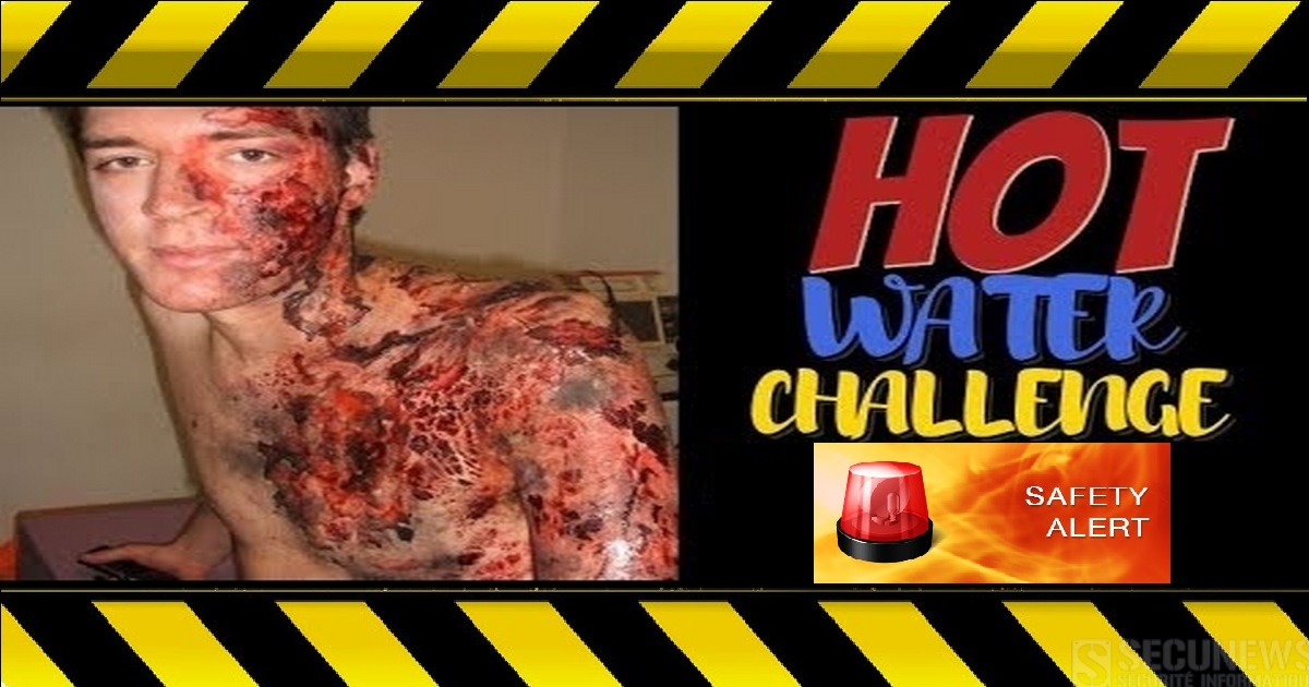 "Hot water challenge", le nouveau défi viral qui fait déjà des victimes